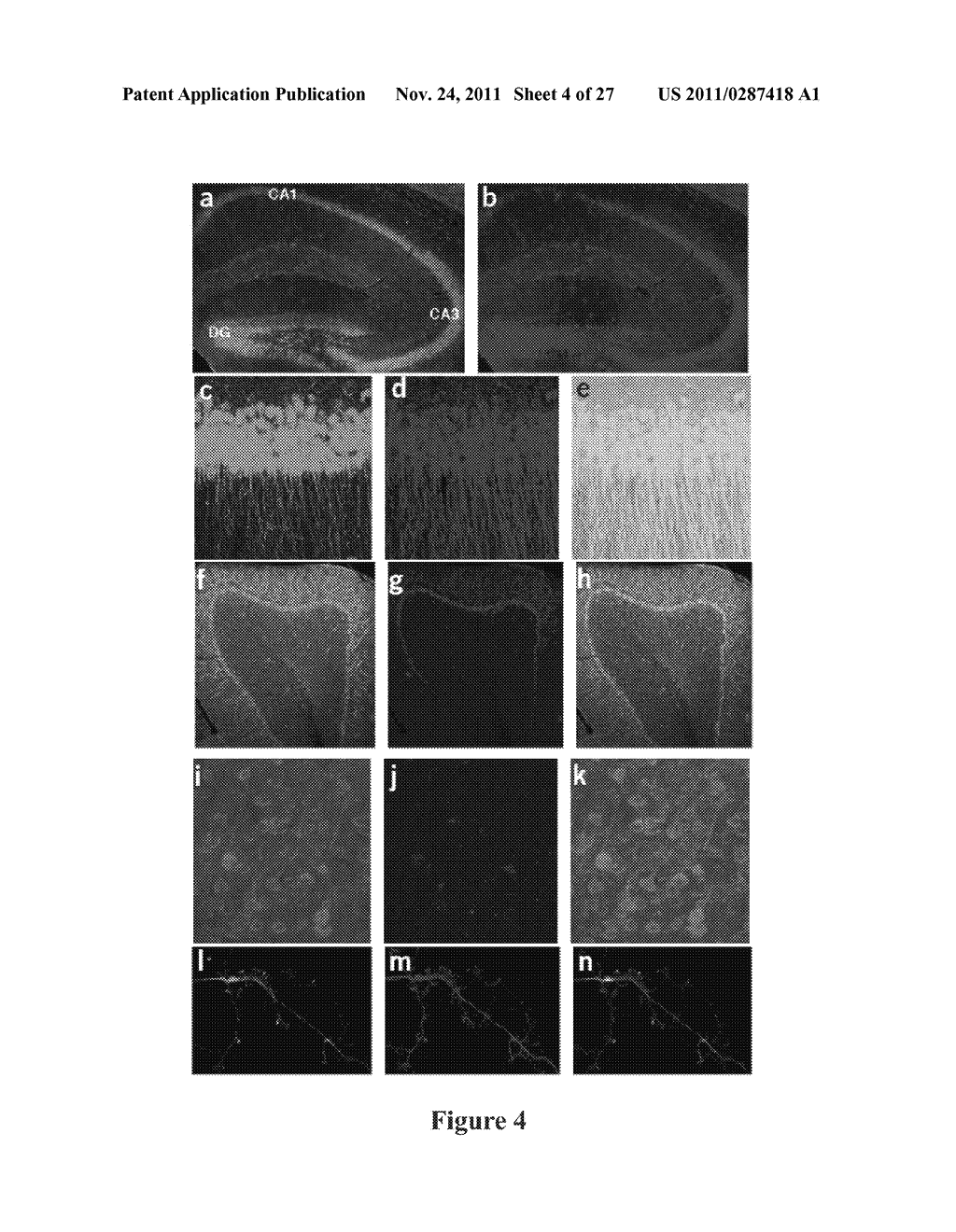 Compositions and Methods for Diagnosis and Treatment of Epilepsy - diagram, schematic, and image 05