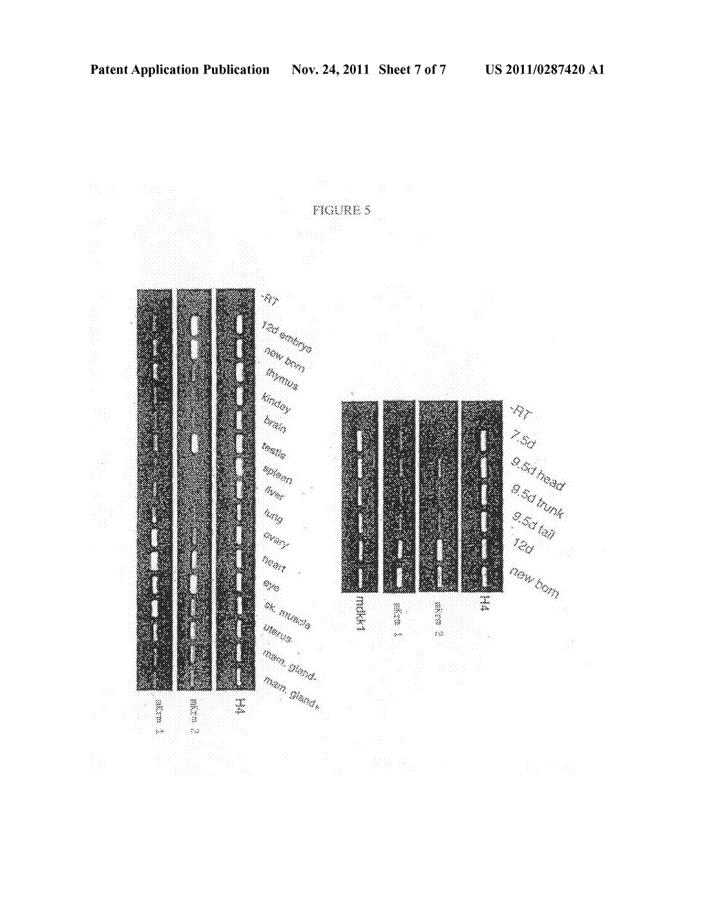 Compositions for diagnosis and therapy of diseases associated with     aberrant expression of kremen and/or WNT - diagram, schematic, and image 08