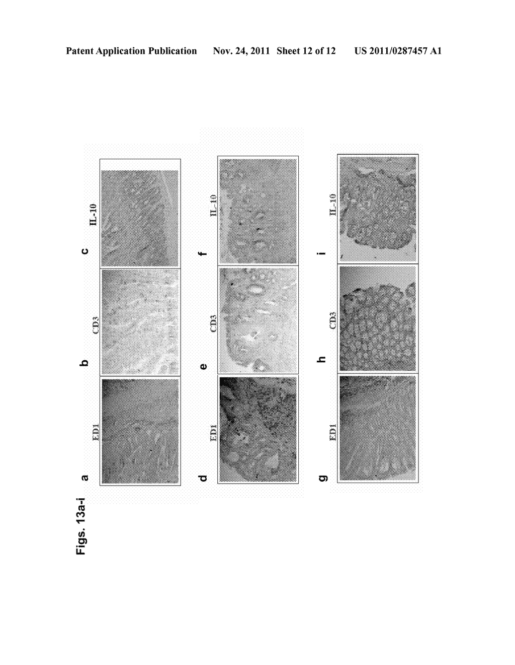 COMPOSITIONS AND METHODS FOR DIAGNOSING AND TREATING AN INFLAMMATION - diagram, schematic, and image 13