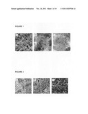 Method of surface treatment of aluminum foil and its alloy and method of     producing immobilized nanocatalyst of transition metal oxides and their     alloys diagram and image