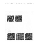 Method of surface treatment of aluminum foil and its alloy and method of     producing immobilized nanocatalyst of transition metal oxides and their     alloys diagram and image