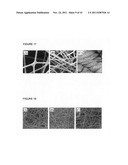 Method of surface treatment of aluminum foil and its alloy and method of     producing immobilized nanocatalyst of transition metal oxides and their     alloys diagram and image