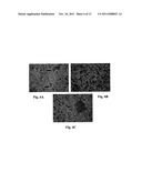 ADMINISTRATION OF ANGIOCIDIN FOR THE TREATMENT OF CANCER diagram and image