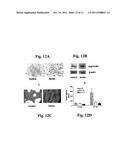 ADMINISTRATION OF ANGIOCIDIN FOR THE TREATMENT OF CANCER diagram and image