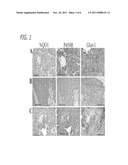 BLADDER CANCER TREATMENT AND METHODS diagram and image