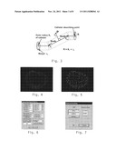 REAL TIME RADIATION TREATMENT PLANNING SYSTEM diagram and image