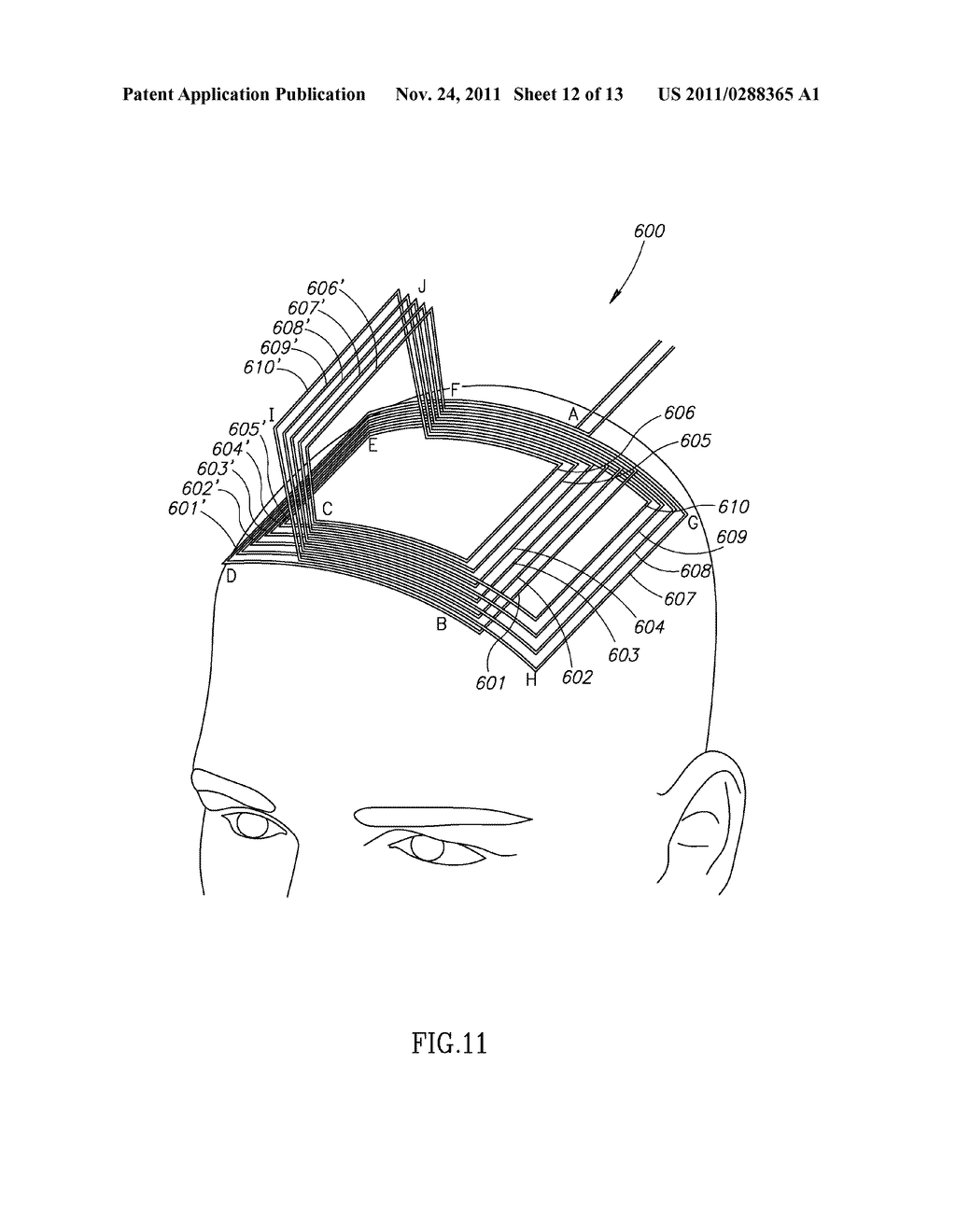 TRANSCRANIAL MAGNETIC STIMULATION SYSTEM AND METHODS - diagram, schematic, and image 13