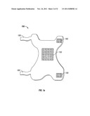 COMPACT APPARATUS AND METHODS FOR NON-INVASIVELY MEASURING HEMODYNAMIC     PARAMETERS diagram and image