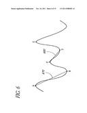 PLETHYSMOGRAPH PULSE RECOGNITION PROCESSOR diagram and image