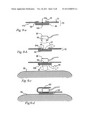 ELECTRODE SYSTEM FOR TRANSDERMAL CONDUCTION OF ELECTRIC SIGNALS, AND A     METHOD OF USE THEREOF diagram and image