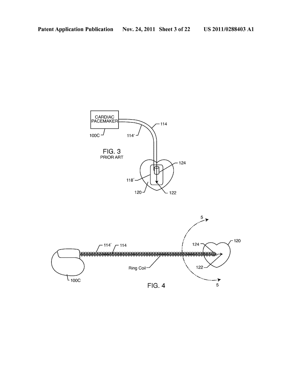 MULTILAYER HELICAL WAVE FILTER FOR MRI APPLICATIONS - diagram, schematic, and image 04