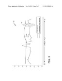 DIASTOLIC CORONARY PERFUSION DETECTION FOR TIMED DELIVERY OF THERAPEUTIC     AND/OR DIAGNOSTIC AGENTS diagram and image