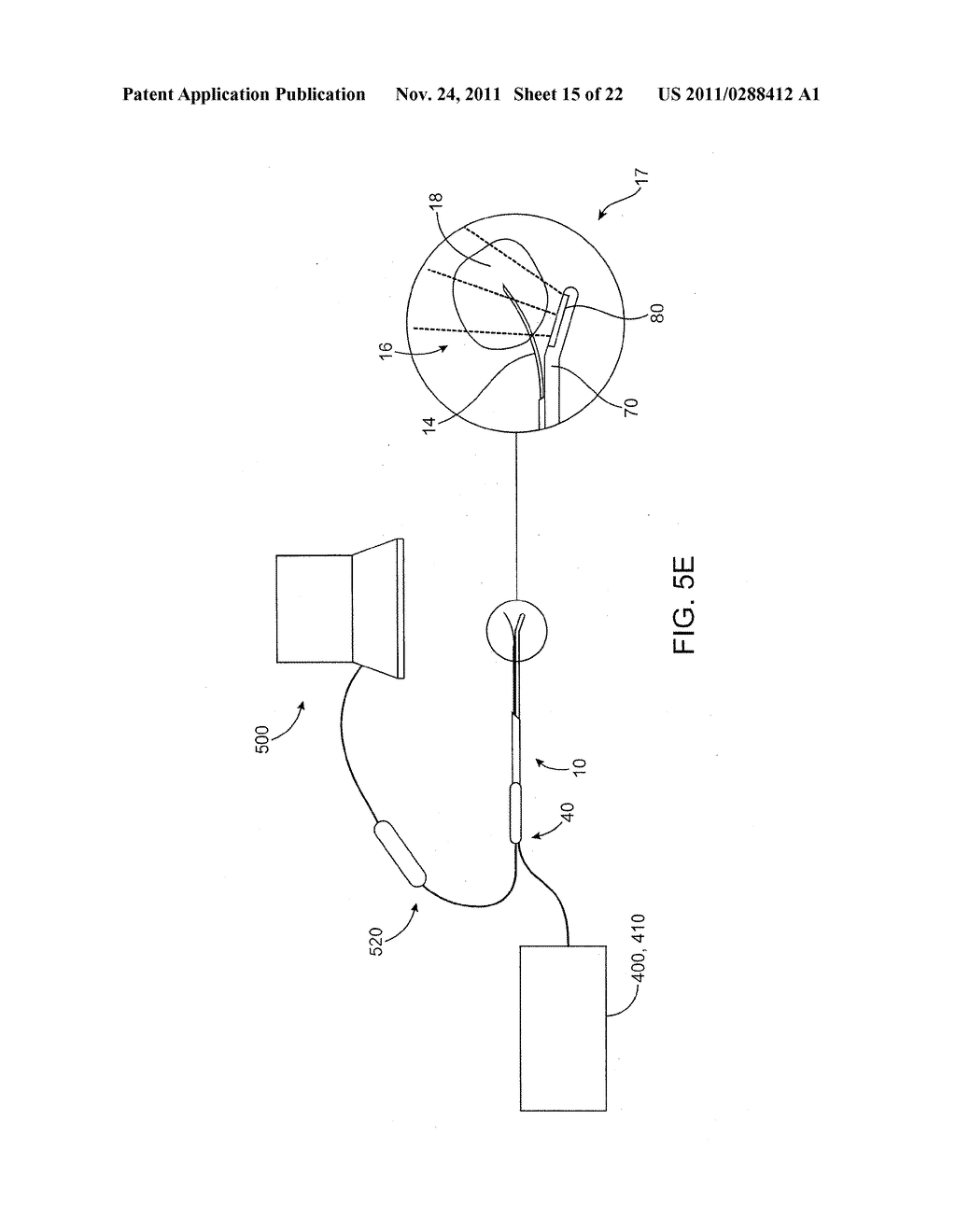 DEVICES AND METHODS FOR TREATMENT OF TISSUE - diagram, schematic, and image 16