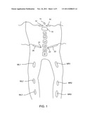 Electromyography System diagram and image