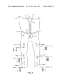 Electromyography System diagram and image