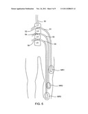 Electromyography System diagram and image