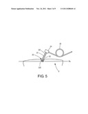 Catalysts for Body Fluid Sample Extraction diagram and image