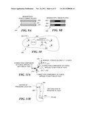 PROSTHETIC LIMB MONITORING SYSTEM diagram and image