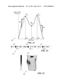 PROSTHETIC LIMB MONITORING SYSTEM diagram and image