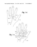 SITE GUARD FOR INTRAVENOUS SITES AND OTHER SENSITIVE AREAS diagram and image