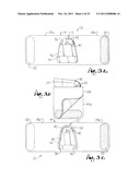 SITE GUARD FOR INTRAVENOUS SITES AND OTHER SENSITIVE AREAS diagram and image