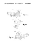 SITE GUARD FOR INTRAVENOUS SITES AND OTHER SENSITIVE AREAS diagram and image