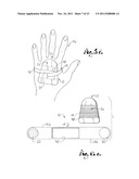 SITE GUARD FOR INTRAVENOUS SITES AND OTHER SENSITIVE AREAS diagram and image