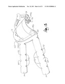 SITE GUARD FOR INTRAVENOUS SITES AND OTHER SENSITIVE AREAS diagram and image