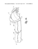 SITE GUARD FOR INTRAVENOUS SITES AND OTHER SENSITIVE AREAS diagram and image