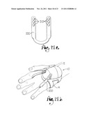 SITE GUARD FOR INTRAVENOUS SITES AND OTHER SENSITIVE AREAS diagram and image