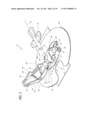 UNIVERSAL CATHETER SECUREMENT DEVICE diagram and image