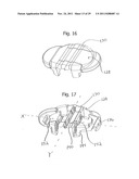 UNIVERSAL CATHETER SECUREMENT DEVICE diagram and image