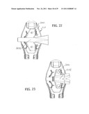 UNIVERSAL CATHETER SECUREMENT DEVICE diagram and image