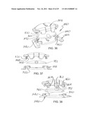 UNIVERSAL CATHETER SECUREMENT DEVICE diagram and image