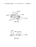 UNIVERSAL CATHETER SECUREMENT DEVICE diagram and image