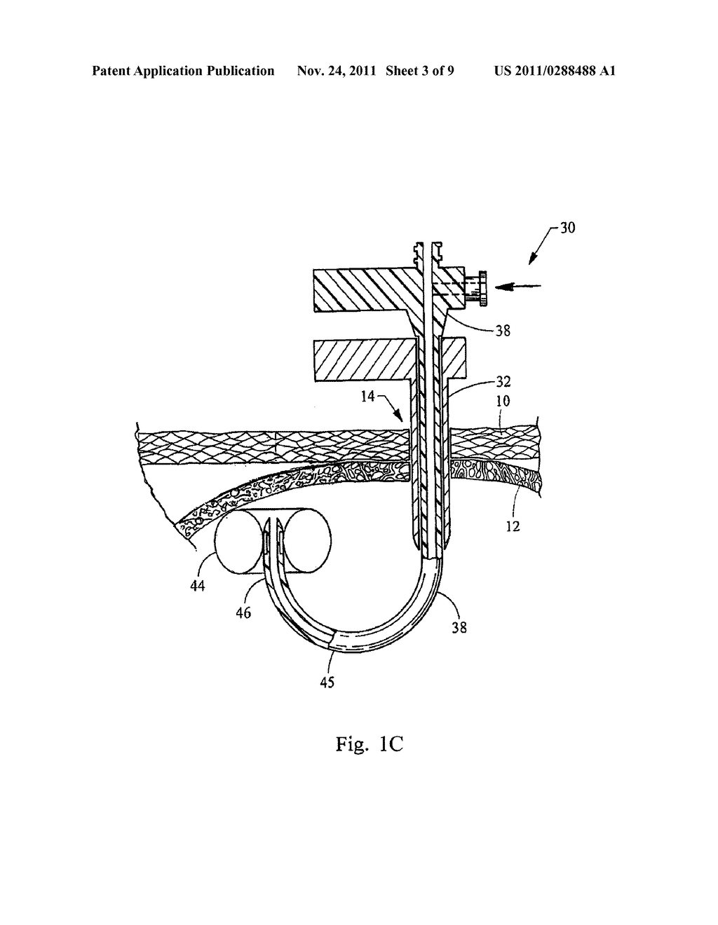 INSIDE OUT T-FASTENER SYSTEM - diagram, schematic, and image 04