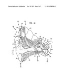 DRUG-DELIVERY ELEMENT FOR AN ELONGATE IMPLANTABLE MEDICAL DEVICE COMPONENT diagram and image