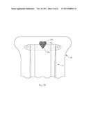 Insert With Advantageous Fastener Configurations And End Stiffness     Characteristics For Two-Piece Wearable Absorbent Article diagram and image