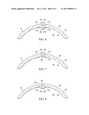 OCULAR SURGICAL PROCEDURE diagram and image