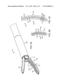 SURGICAL INSTRUMENT AND METHOD diagram and image