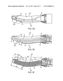 SURGICAL INSTRUMENT AND METHOD diagram and image