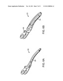 SURGICAL INSTRUMENT AND METHOD diagram and image