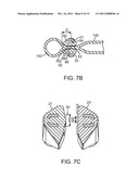 SURGICAL INSTRUMENT AND METHOD diagram and image