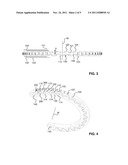 EXTERNAL FIXATION SYSTEM diagram and image