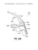 Apparatus for Sizing a Facet Joint diagram and image