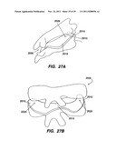 Apparatus for Sizing a Facet Joint diagram and image