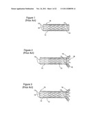 DEPLOYMENT HANDLE FOR AN INTRODUCER diagram and image