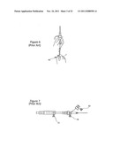 DEPLOYMENT HANDLE FOR AN INTRODUCER diagram and image