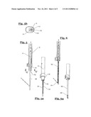 ENDOSCOPIC SUTURING MACHINE diagram and image