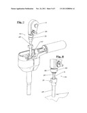 ENDOSCOPIC SUTURING MACHINE diagram and image